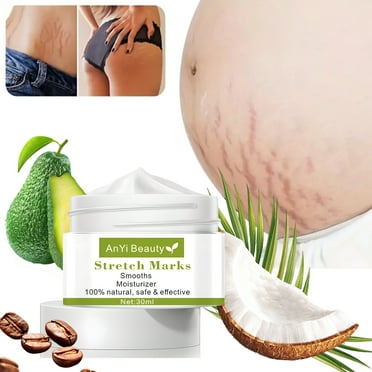 1 Pcs Stretch Marks Scar Cream, Stretch Marks Treatment, Maternity Repair, Recovery Elasticity, Repair Scar Slack Line Abdomen Stretch Marks Postpartum,30ml/Pcs