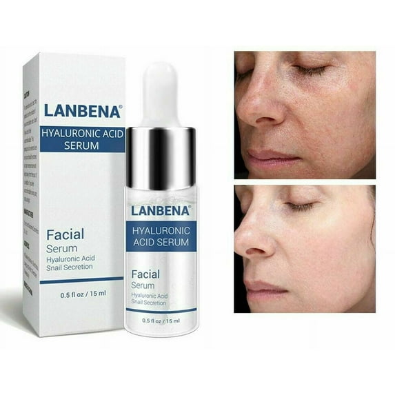100% Pure HYALURONIC ACID SERUM Anti-Aging-Plumps Wrinkles-Intense Hydration-15m