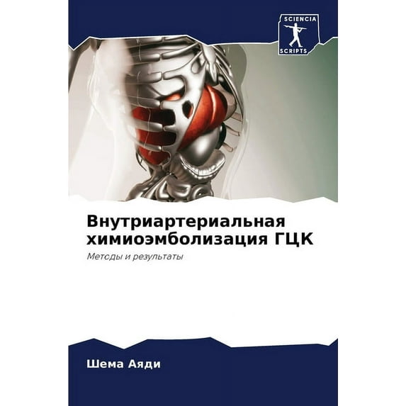 Внутриартериальная химиоэмбол