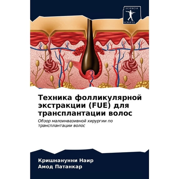 Техника фолликулярной экстракц&#