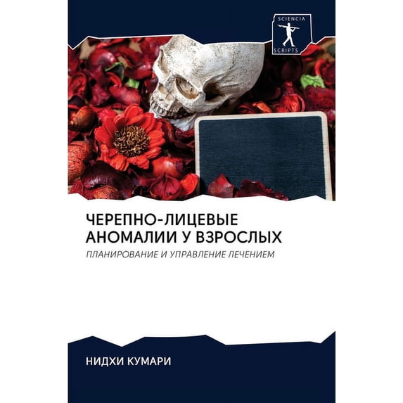 ЧЕРЕПНО-ЛИЦЕВЫЕ АНОМАЛИИ У ВЗРОС - Walmart.com