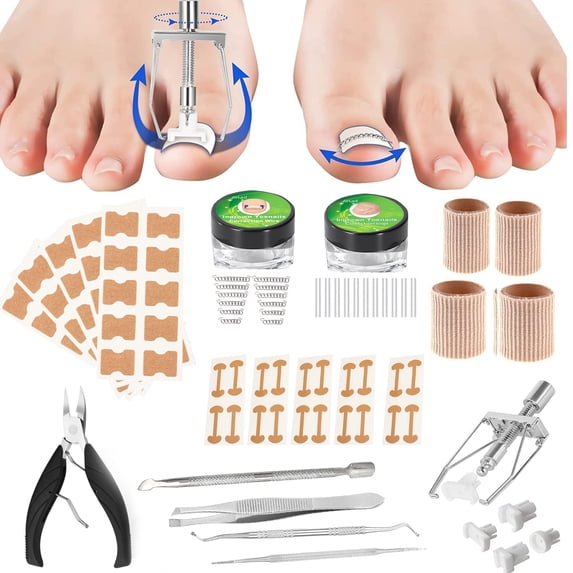In Growing File 107PCS Ingrown Toenail Treatment Kit, Pedicure Tools, Nail File Lifter ...