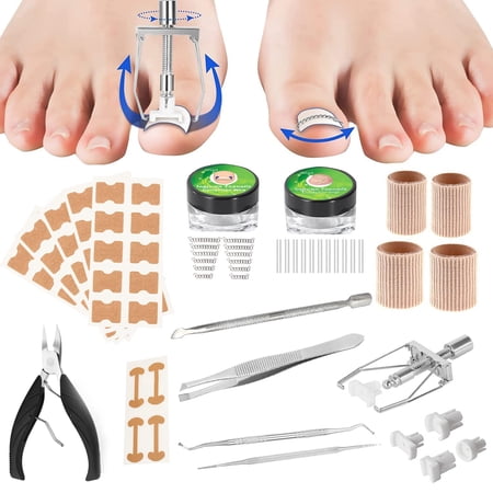 107PCS Ingrown Toenail Treatment Kit, Ingrown Toenail Tool Kit, Ingrown Toenail Corrector Strips, Ingrown Toe Nail File Lifter Pedicure Tool Kits for Toenail Correction Pain Relief