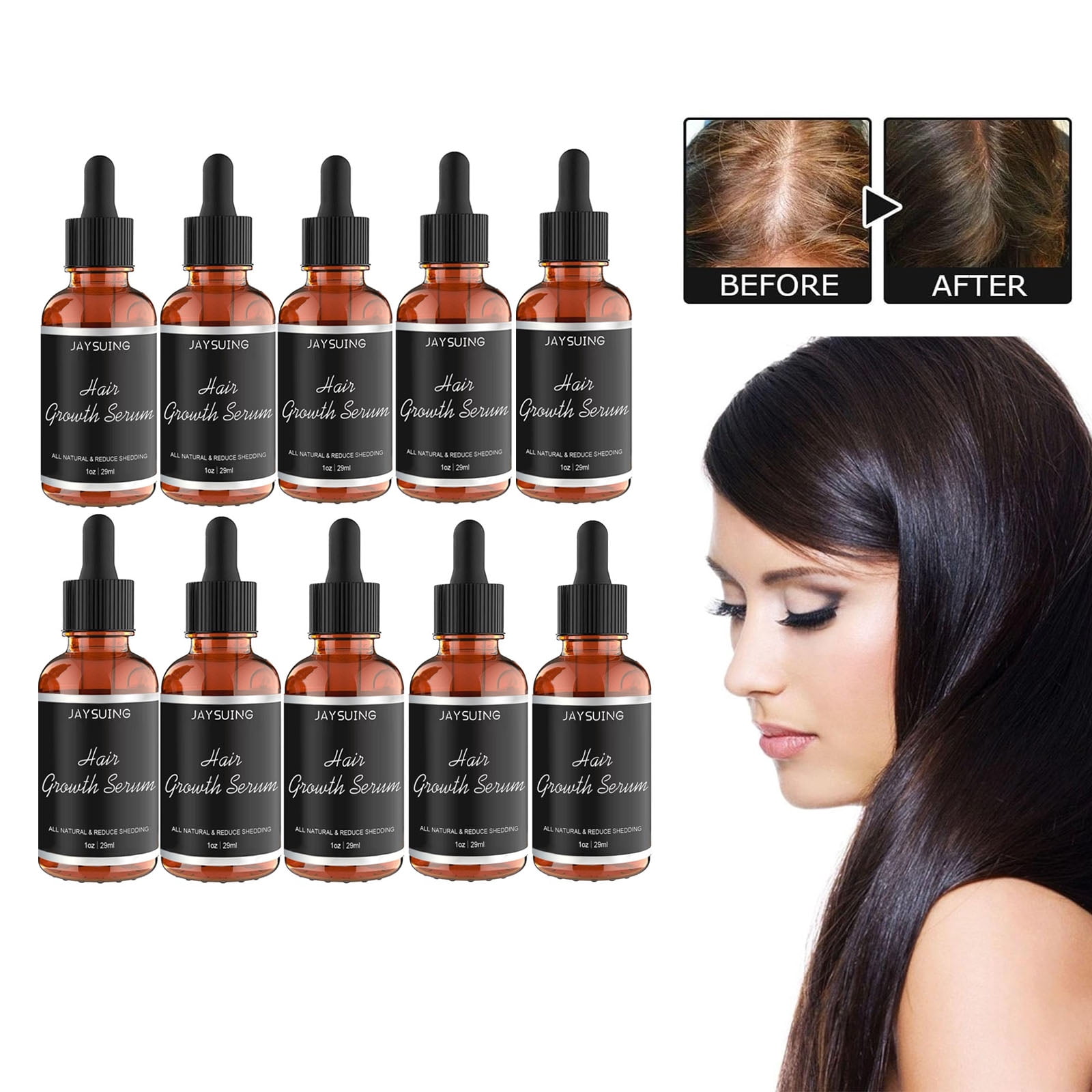 10PCS Hair Growth Serum African Olives,Hair Growth Serum, Love Hair Serum, African Hair Oil, For Dry Hair, Thicker Fuller, Hair Loss Oil