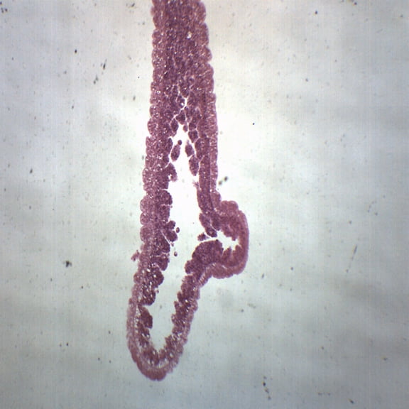 10PK Hydra, Longitudinal Section - Prepared Microscope Slides - Classroom Pack, 10 Slides in Storage Case - Biology & Microscopy - Eisco Labs