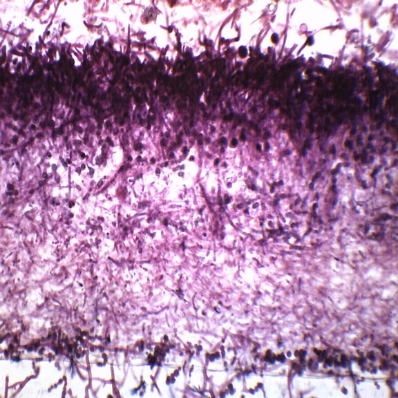 10PK Mucor, Wholemount - Prepared Microscope Slides - Classroom Pack, 10 Slides in Storage Case - Biology & Microscopy - Eisco Labs