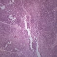 thumbnail image 1 of 10PK Thymus, Cross Section - Prepared Microscope Slides - Classroom Pack, 10 Slides in Storage Case - Biology & Microscopy - Eisco Labs, 1 of 3