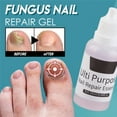 10ml Nail Fungus Liquid Onychomycosis Paronychia Anti Fungal Nail Care