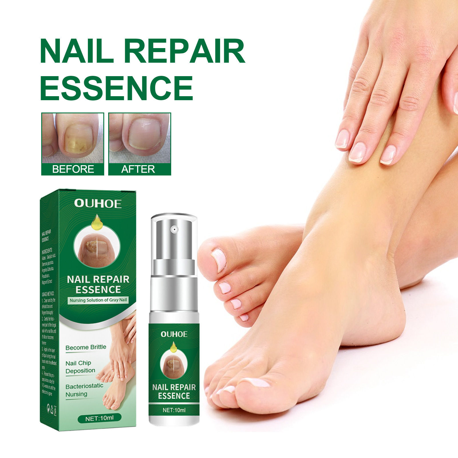 10ml Nail Repair Antibacterial Solution Treating Nail Discoloration And