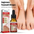 10mlIngrown Toenail Ingrown Toenail Pain Relief And Softener Kit For