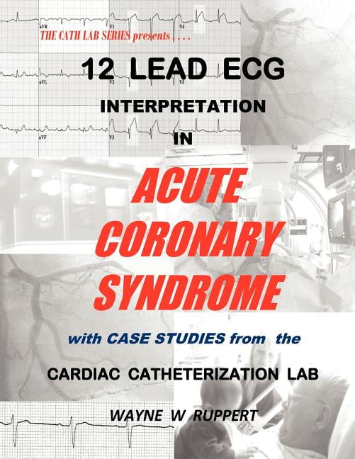 12 Lead ECG Interpretation in Acute Coronary Syndrome with Case Studies