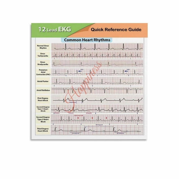 12 Lead EKG Quick Reference Guide Poster Common Heart Rhythms Knowledge Education Canvas Painting Posters And Prints Wall Art for Living Room Bedroom Decor