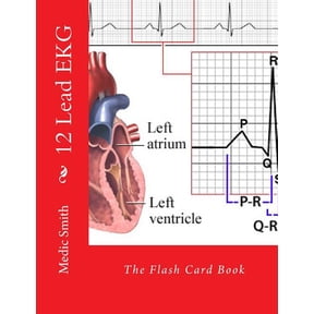 12 Lead EKG: The Flash Card Book (Paperback)