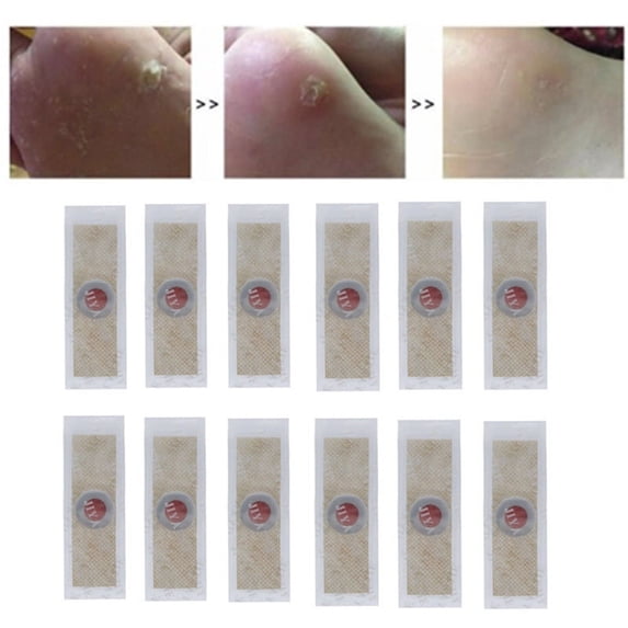 12pcs Medical plaster Foot Corn Removal Remover Warts Thorn Plaster Of Calluses Patch Callosity Detox Foot Pad Foot Care Tools