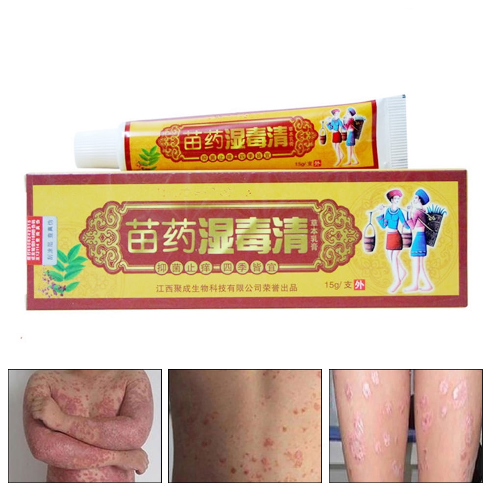 15g Fungus Anti Bacterial Cream Natural Chinese Herbs Cream Ointment