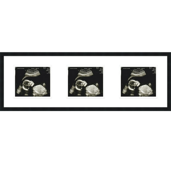 16x5 Black Sonogram Frame with White on White Mats with 3 Openings to Display 3 4x3 Sonograms -