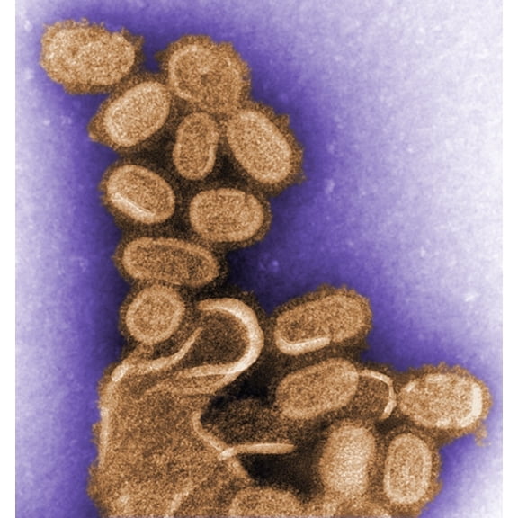 1918 Influenza Virions . History Poster Print