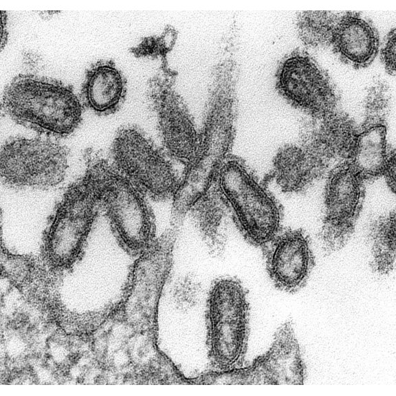 1918 Influenza Virions (Virus Particles). History (24 x 18)