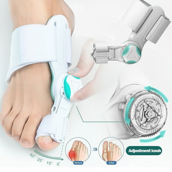 Birdsexy 1PC Big Toe Straightener Adjustable Toe Corrector Knob Hallux Valgus Correction Toe Bunion Separators Foot Care Supplies