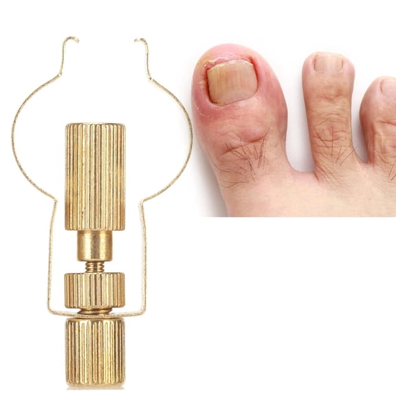 1Pack Ingrown Toenail Lifter Foot Care Tool, Toenail Clamp Stainless, Steel Ingrown Toenail Tools, Stainless Steel Professional For Paronychia, Ingrown Toenail Clamp