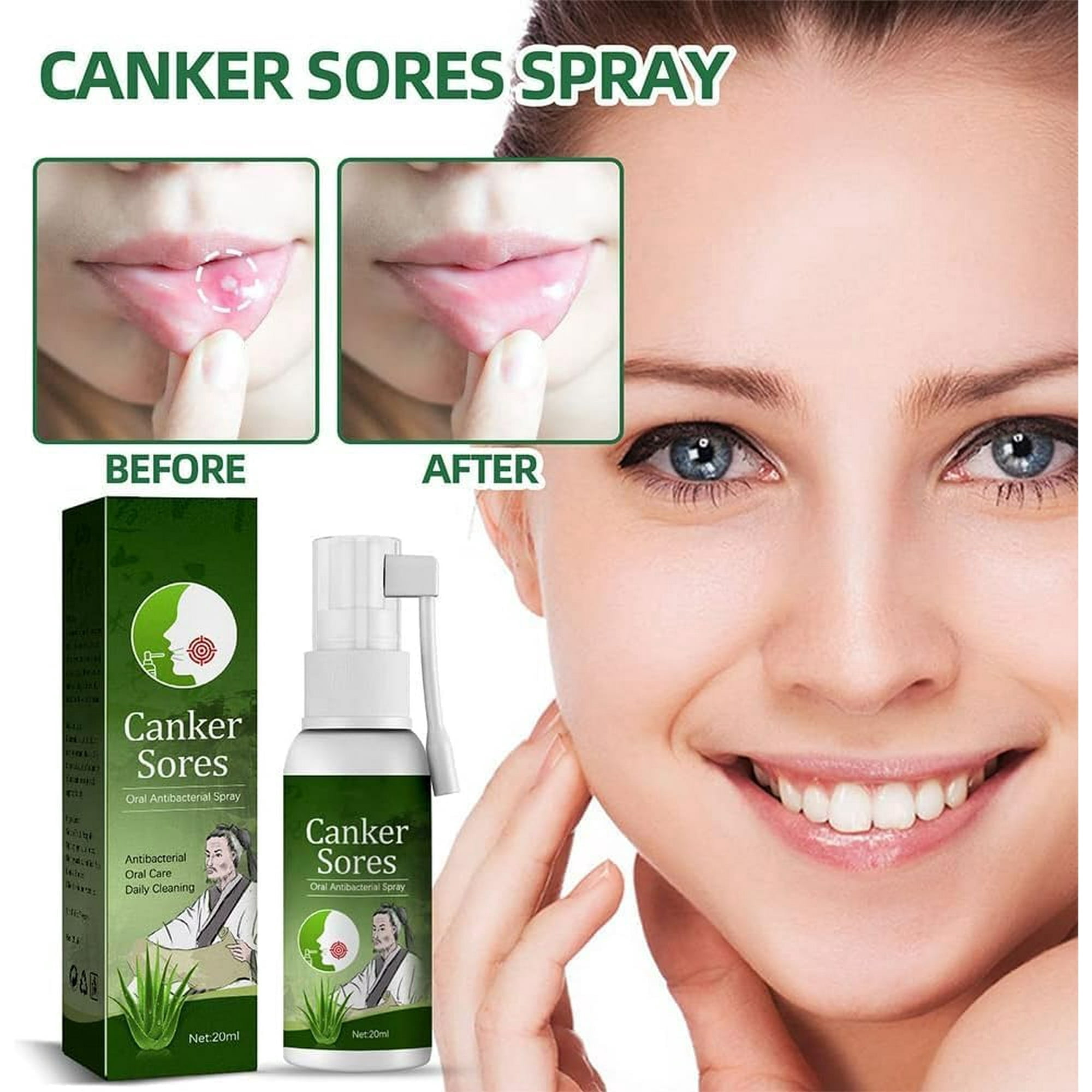 1Pcs Oral Ulcer Relief Spray, Professional Safe Canker Sore Spray，Rapid absorption For Oral Care For Men Women,Oral Treatment for Sores