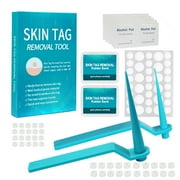 2-8mm 2 In 1 Skin Tag Rubber Band Set Of 20 Large 20 Small Rubber Bands And 1 Repair Sticker