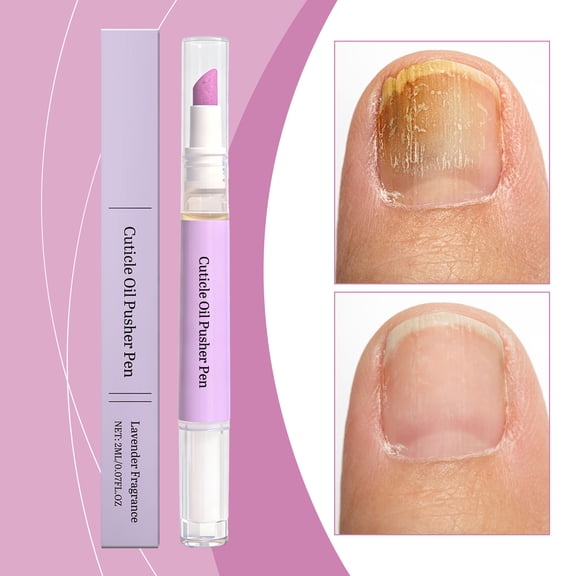 2-In-1 Cuticle Oil Pusher Pen, Ceramic Cuticle Oil Cuticle Pusher Nail Oil Pen For Hangnails & Dry & Damaged Nails, Nail Care Tool For Repair & Nourish Nails,2ml,1Pc