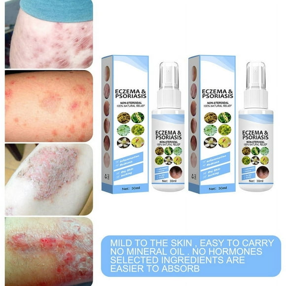 2 PCS Anti Itch Spray &Antiseptic, Bacteriostatic Spray Body Itch Psoriasis Relief Moisturizing Spray for Psoriasis Treatment for Foot odor & eczema, Dry Skin Itch Relief Body Care