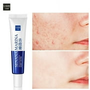 2 Pack Acne Removal Nicotinamide Cream Aloe Vera Oil Control Shrink Pores