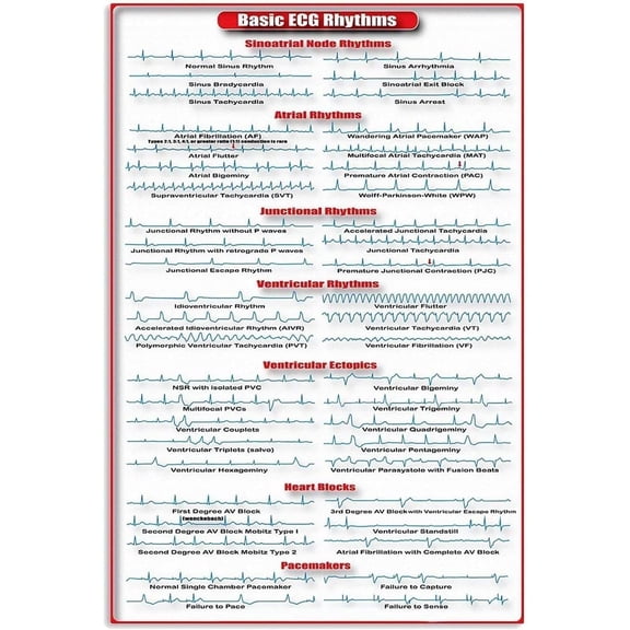 2 Pack Basic Ecg Rhythms Infographic Metal Sign Cardiology Study Guide Tin Poster Cardiologist Office Decor Doctor Hospital Home Wall Décor 8x12 inches