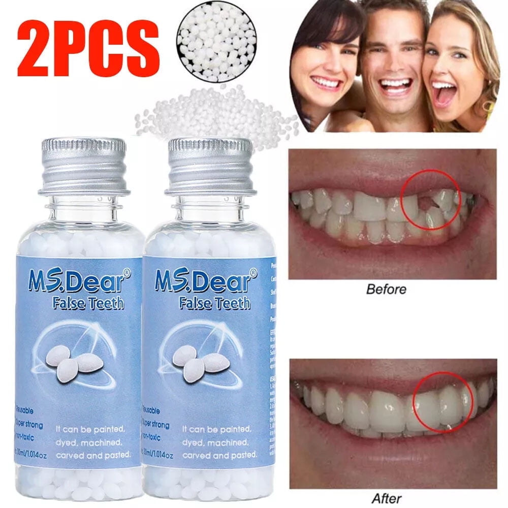 2 Pack False Teeth Solid Glue Temporary Tooth Repair Moldable Fix Broke Gap Teeth Kit -Thermal Fitting Beads for Snap on Instant and Confident Smile