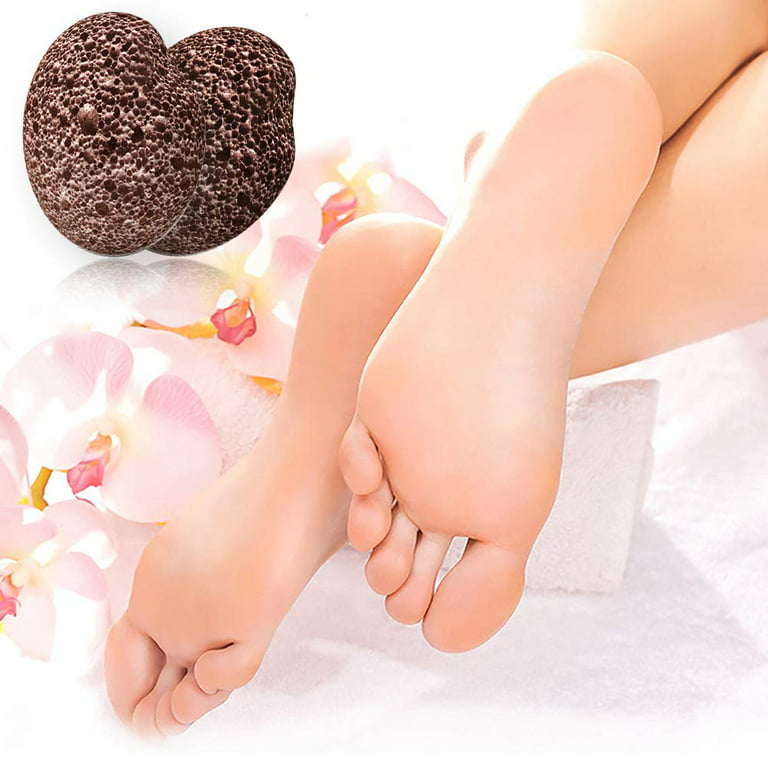 2PCS Foot Pumice Stone Foot File Callus Dead Skin Remover Foot Heel  Scrubber Smooth Feet In Seconds Pedicure Exfoliator Tool