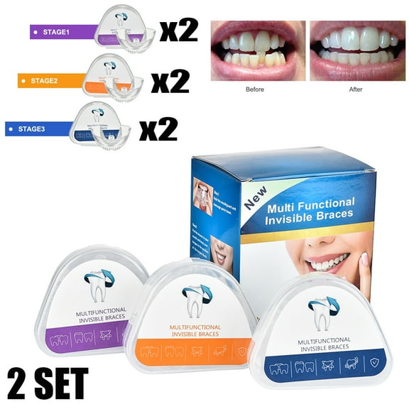 2 Set Dental Braces Kit, 3 Stage Teeth Straightener for Adults Orthodontic Teeth Trainer,Tooth Retainers for Adult Teen