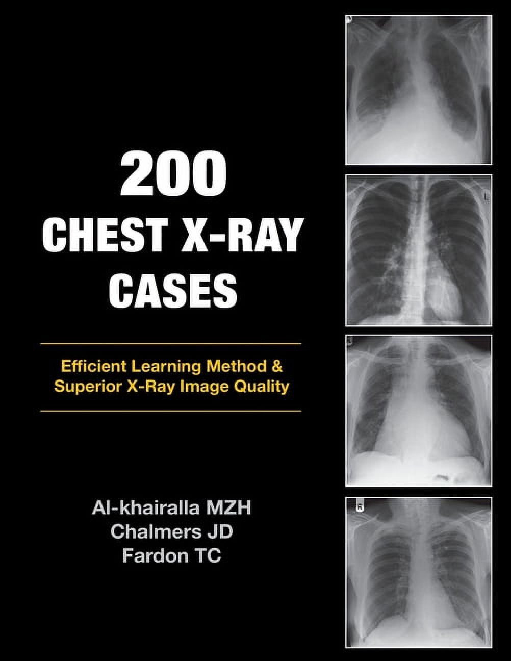 200-Chest-X-Ray-Cases-