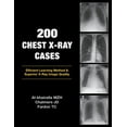 thumbnail image 1 of 200 Chest X-Ray Cases, (Paperback), 1 of 1
