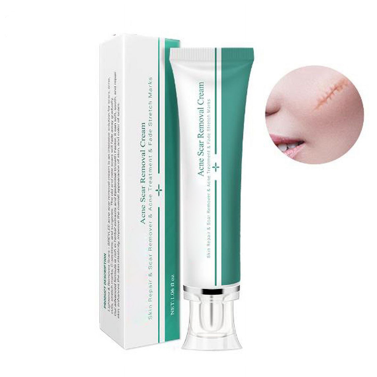 2024 Scar Removal Cream Acne Spot Treatment Gel Skin Care Cream Safe