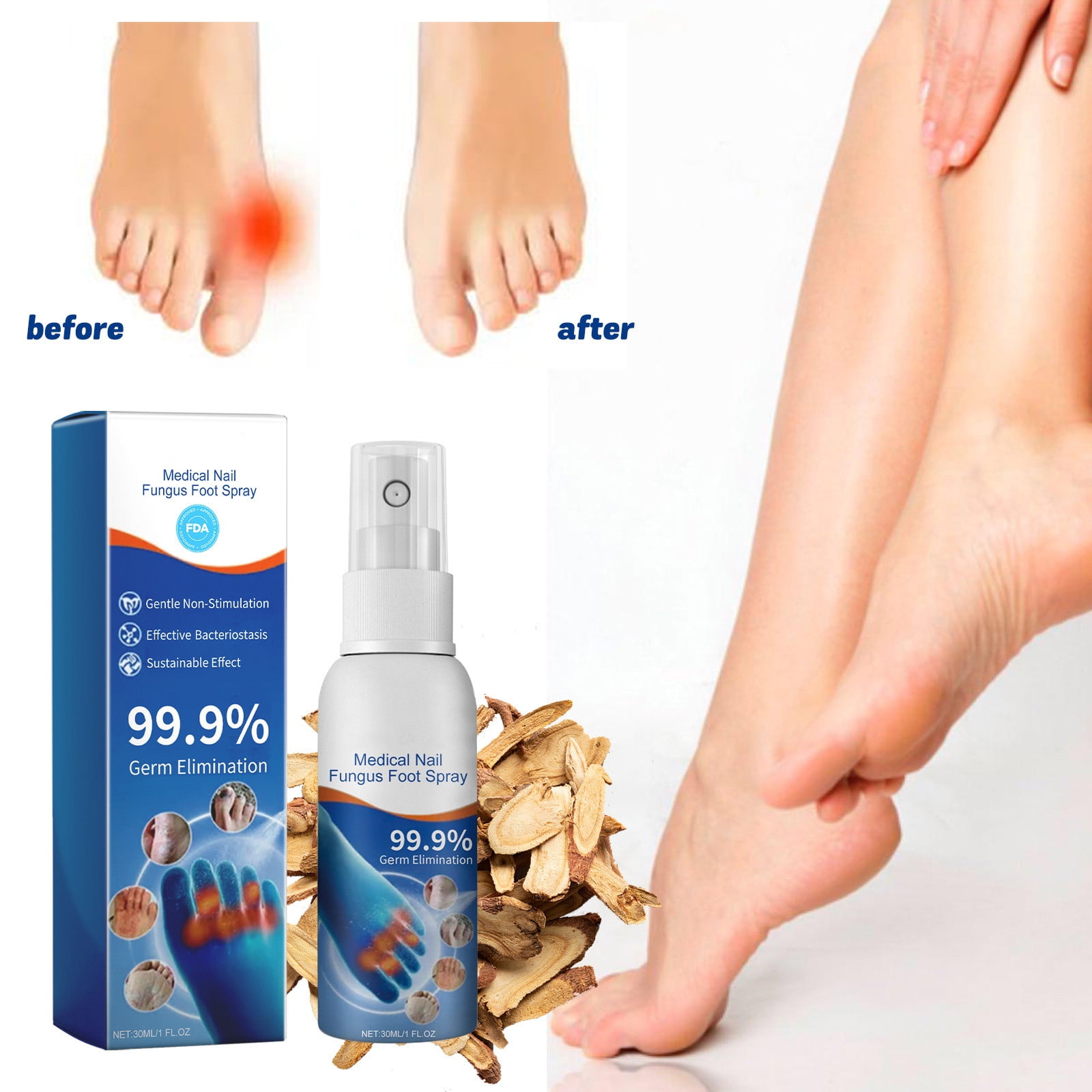 2025 New Medical Nail Fungus Foot Spray, Fungal Nail Treatment Spray ...