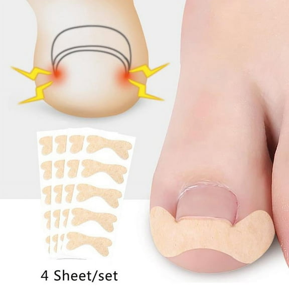 20Pcs Toenail Corrector Ingrown Toe Foot Nail Correction Patch Nail Sticker