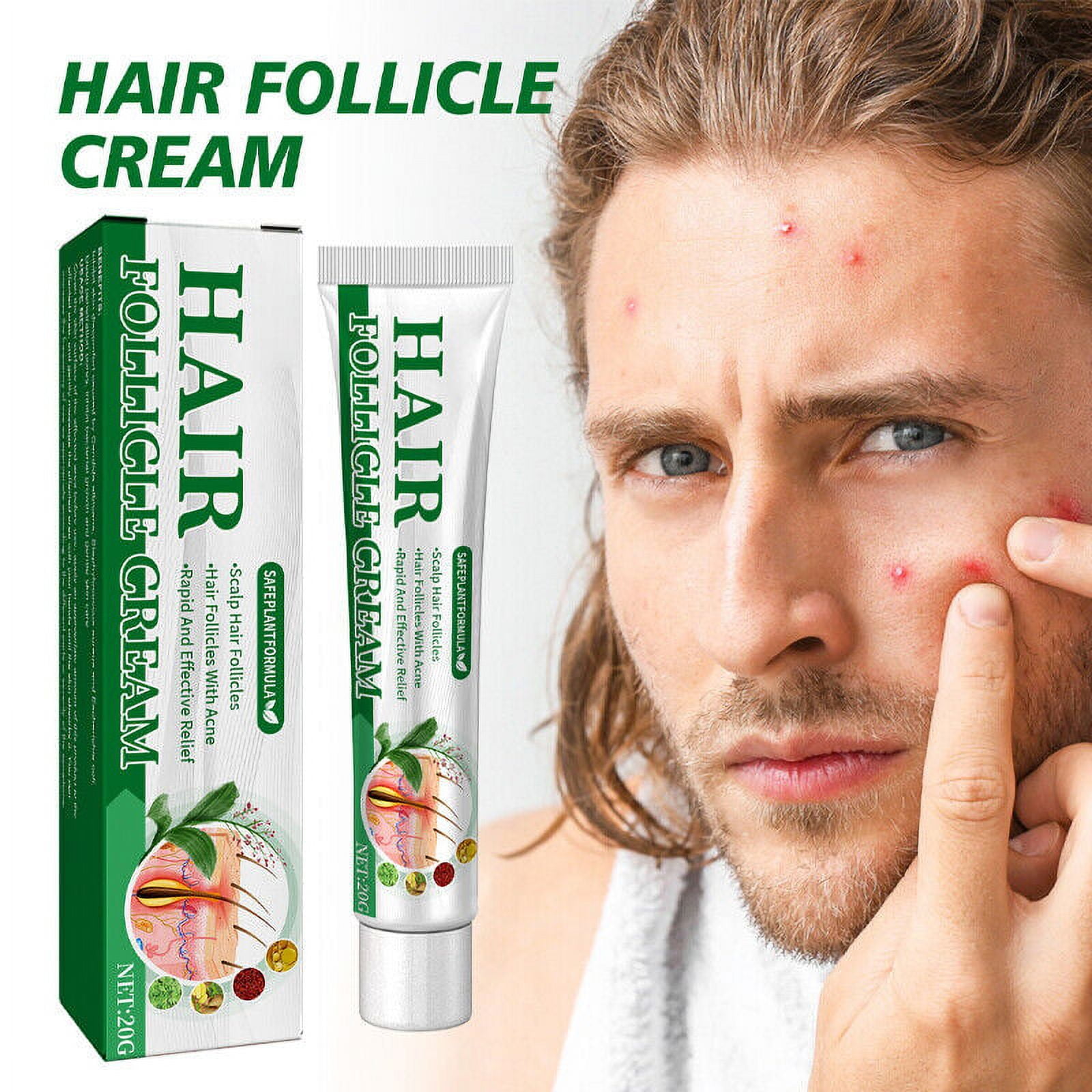 Folliculitis cream sale