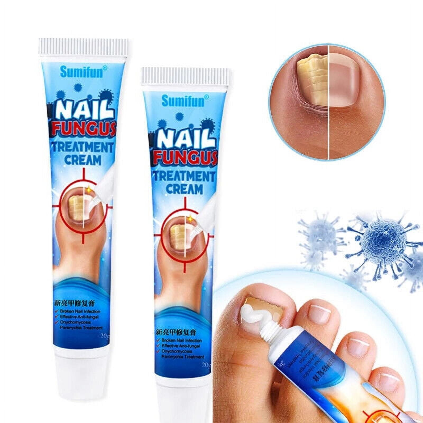 20g Nail Fungus Removal Cream Onychomycosis Fungal Nail Treatment -  Walmart.com