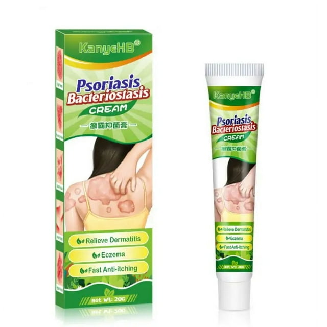 20g Psoriasis Cream Eczema Ointment Scalp Psoriasis Hand Tinea Foot