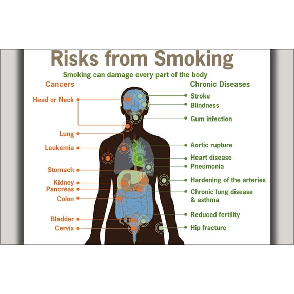 24"x36" Gallery Poster, health Risks from smoking cdc diagram cancer heart disease