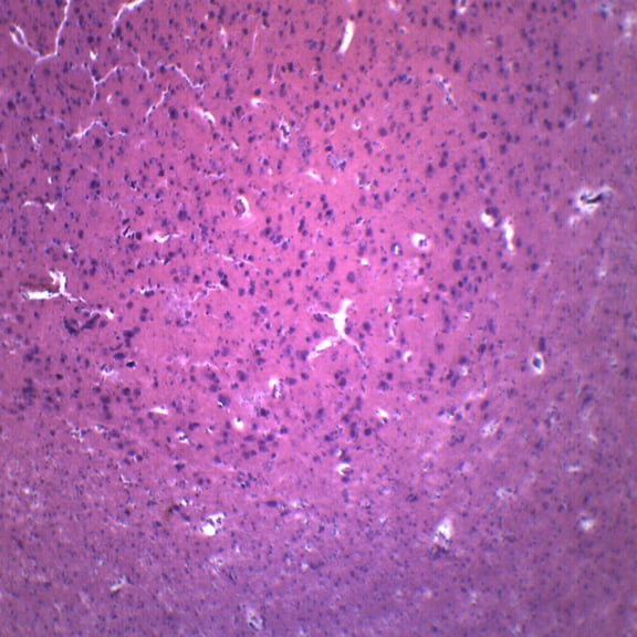 25PK Brain Section, Mammal - Prepared Microscope Slides - Classroom Pack, 25 Slides in Storage Case - Biology & Microscopy - Eisco Labs