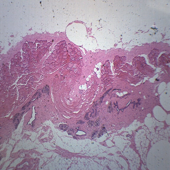 25PK Mammary Gland Section - Prepared Microscope Slides - Classroom Pack, 25 Slides in Storage Case - Biology & Microscopy - Eisco Labs