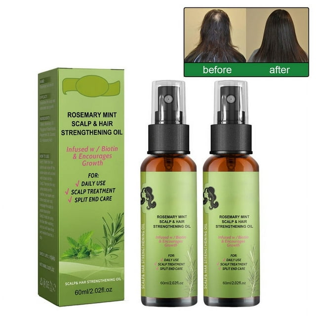 2PCS Organics Rosemary Mint Scalp & Hair Strengthening Oil With Biotin & Essential Oils, Nourishing Treatment for Split Ends and Dry Scalp for All Hair Types, 2-Fluid Ounces