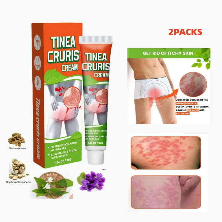 4 Ways to Relieve Groin Eczema - It's an Itchy Little World