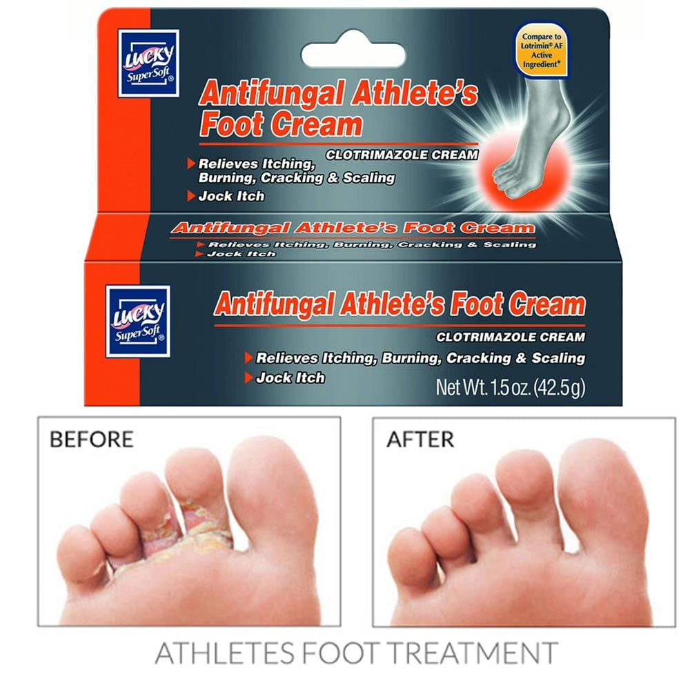Imperial Feet Antifungal Skin Cream - Athletes Foot Treatment - Jock Itch Cream Extra Strength - Ringworm Treatment for Humans - XL - used by
