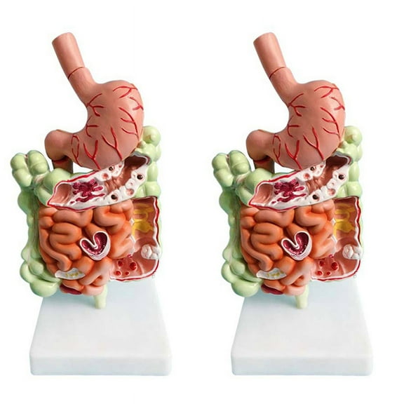 2X Human Digestive System Model Stomach Anatomy Large Intestine Cecum Rectum Duodenum Internal Organs