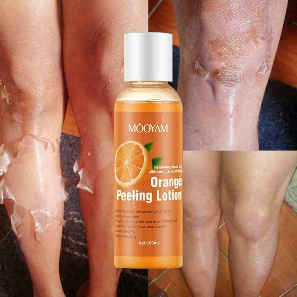 Derma Shine Dead Skin Remover Peeling Gel (200gm) –