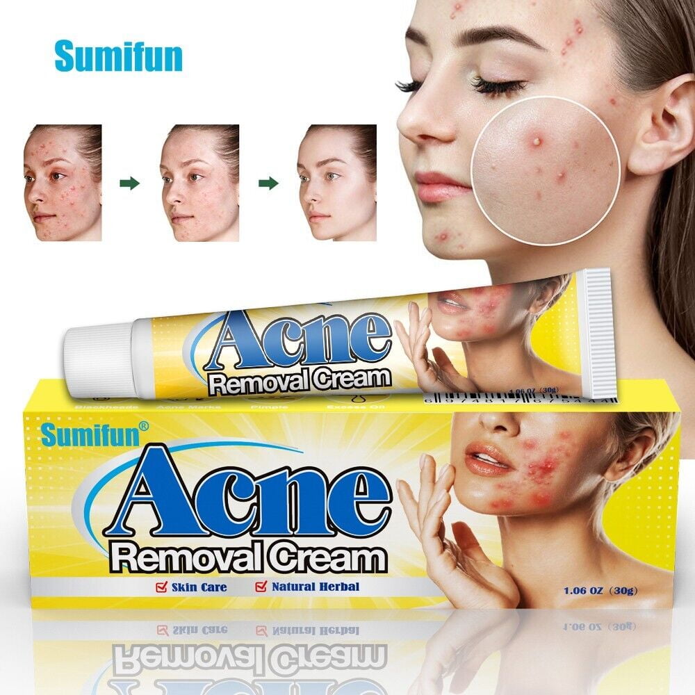 30g Acne Removal Cream Pimple Pits Pustule Deep Cleaning Face Repair